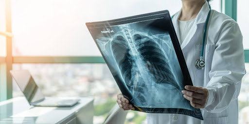 5 facts about lung cancer every Utahn should know