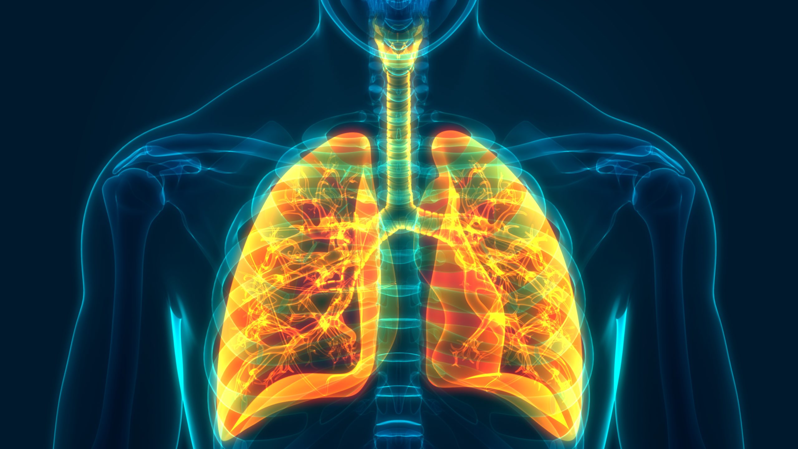 Radon as the second leading cause of lung cancer