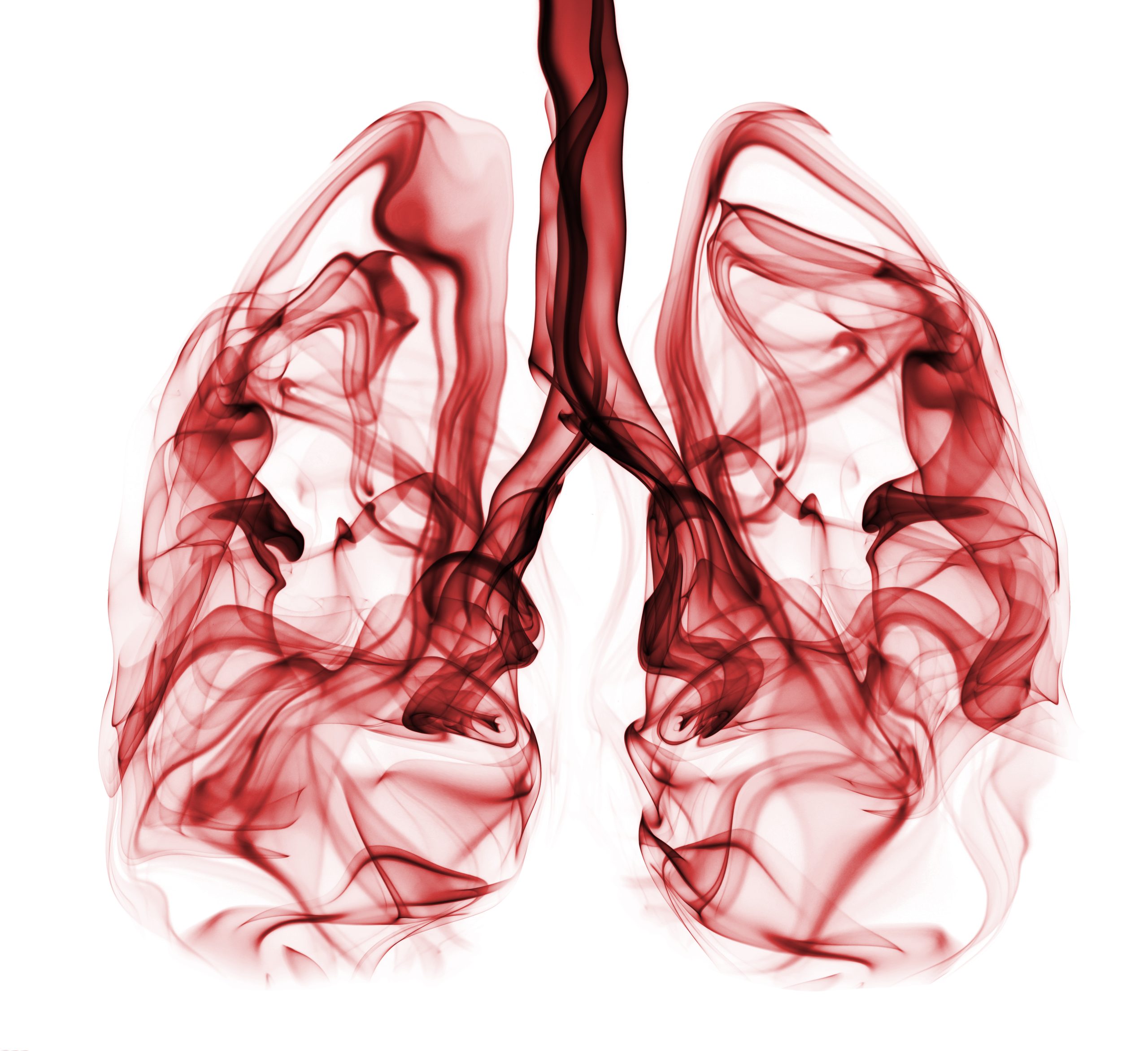 The full-spectrum impact of a lung cancer diagnosis