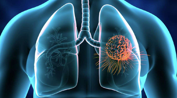 American Lung Association encourages Utah residents to test their homes for radon this month